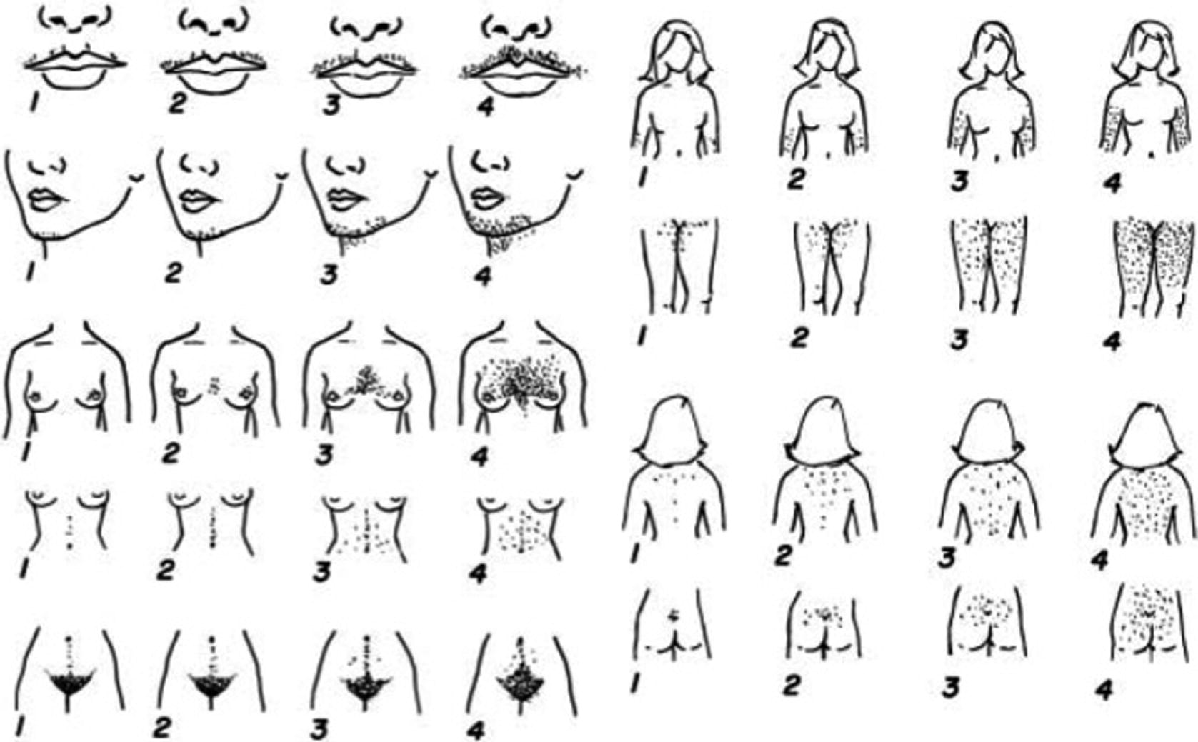 модифицированная шкала ферримана-голлвея. развитие по мужскому типу. человек среднего телосложения. развитие по мужскому типу. типы телосложения у мужчин.