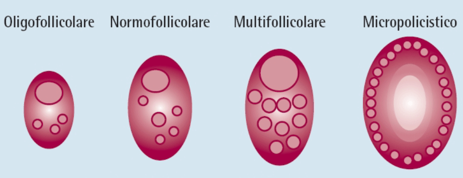 Ormone antimulleriano